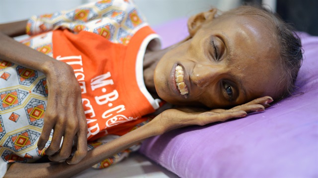UNICEF'e göre, Yemen'de yaklaşık 10 milyon çocuk acil insani yardıma ihtiyaç duyuyor.

