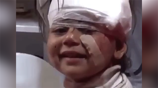 Bombardımandan kurtulan minik kız kameraya böyle gülümsedi