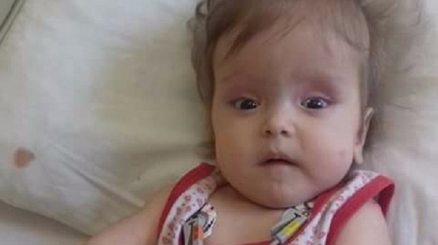 Tedavi altına alınan Sümeyye bebeğe birçok kez tahlil yapılmasına rağmen neden karnının şiştiği henüz anlaşılamadı.