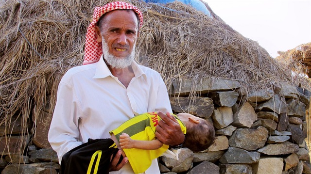 İç savaşın ve koleranın vurduğu Yemen'de 10 milyon çocuk yardıma muhtaç durumda.