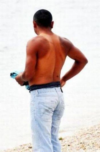 Summer is coming: Yanlış güneşlenmenin 10 ibretlik sonucu