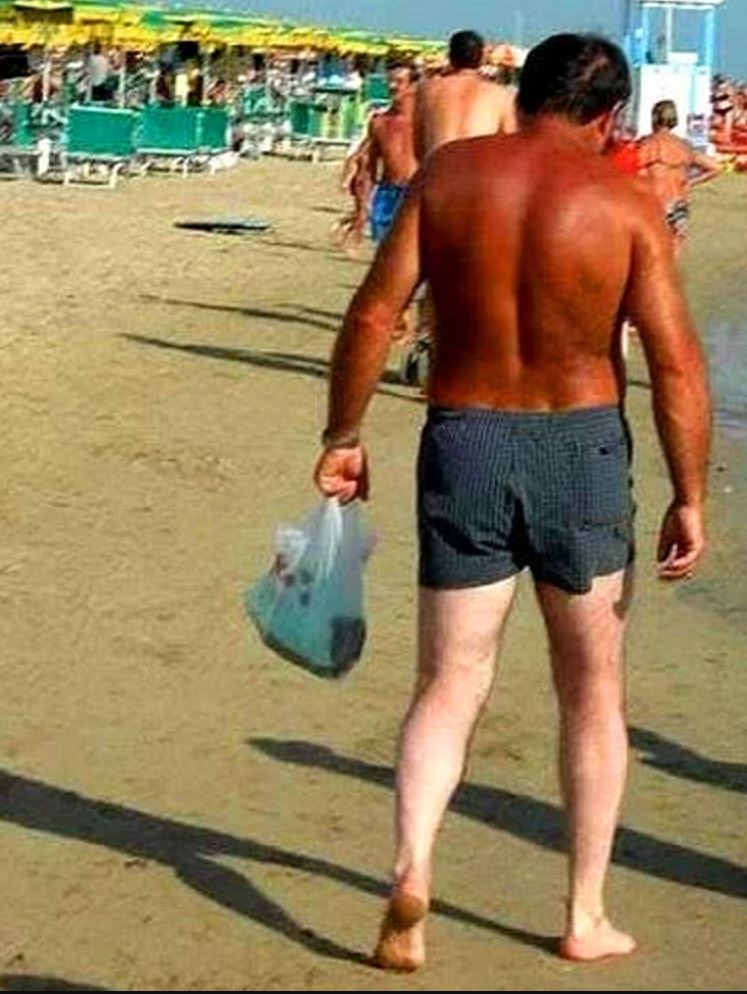 Summer is coming: Yanlış güneşlenmenin 10 ibretlik sonucu