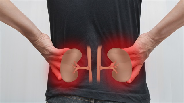 Hastalık böbrekleri. Belirtiler ve bulgular Hastalık böbrekleri. Belirtiler ve bulgular