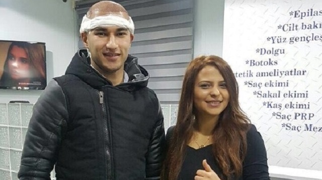 Saç kıran tüm kafa, sakal, bıyık gibi kıl olan tüm alanlarda görülebilir.
İleri düzey sakal veya saç kıran oluşumunda dermatoloji uzmanına başvurmak gerekir.