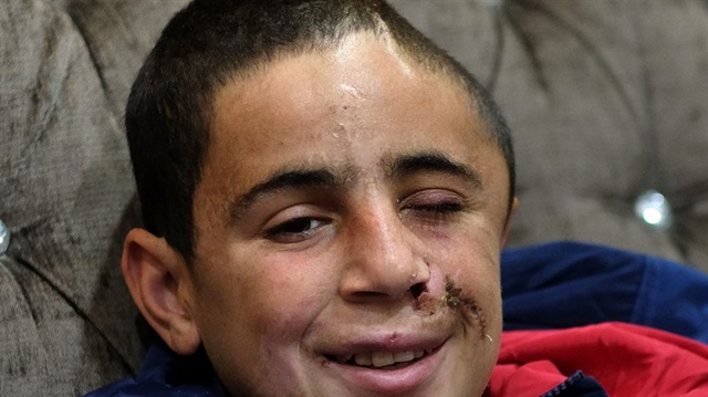 İsrail zulmünün kurbanı: 15 yaşındaki Muhammed