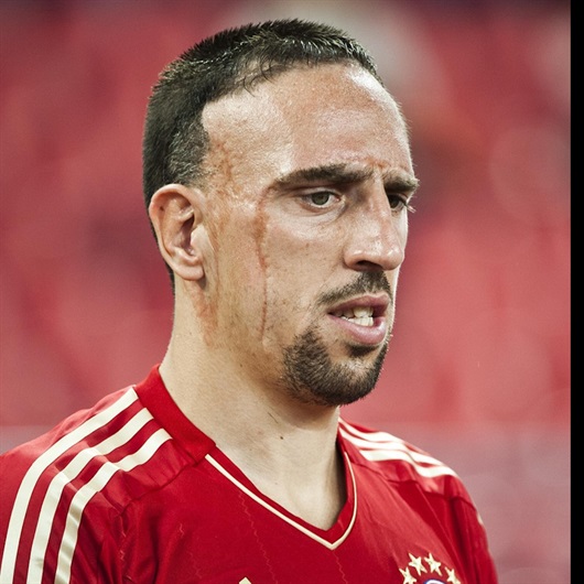 Yaralı Yüz: Franck Ribery