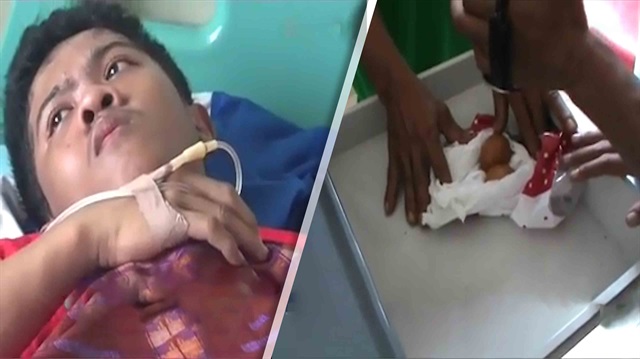 İnanılmaz olay: Yumurtlayan çocuk doktorları şaşkına çevirdi!