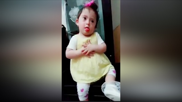 İzlenme rekorları kıran down sendromlu bebek