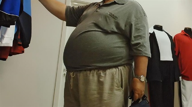 Daha önce dünyanın dörtte biri obezken, şimdi üçte biri obez.