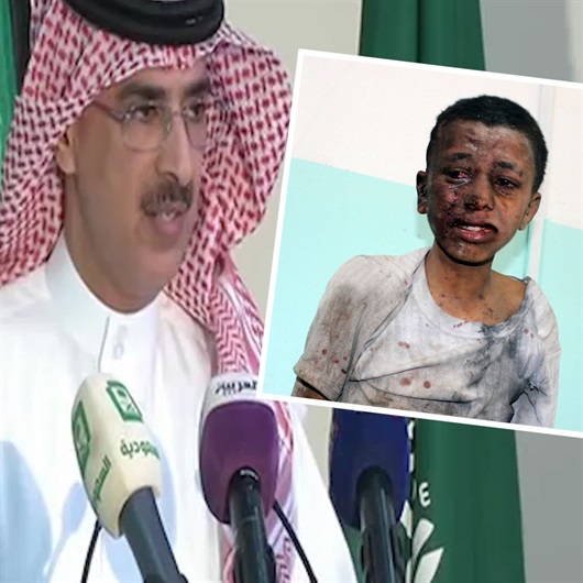 Suudi Arabistan Yemen’deki katliama ‘hata’ dedi