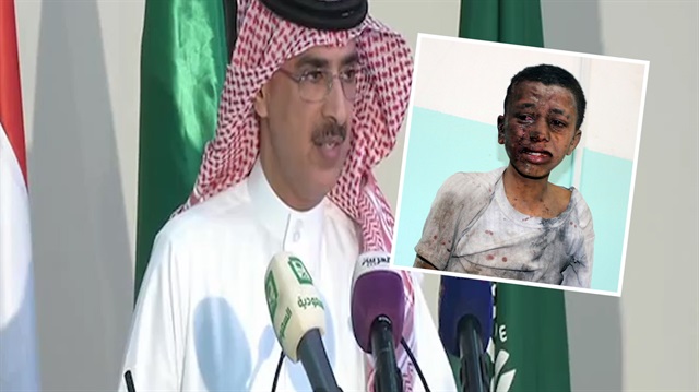 Suudi Arabistan Yemen’deki katliama ‘hata’ dedi