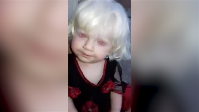 Kırmızı gözlü bebeği görenler gözlerine inanamıyor