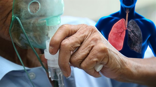 Hızla yayılıyor: 1 milyar kişiyi öldürecek