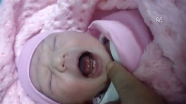 Dokuz dişli doğan bebek görenleri şaşırttı