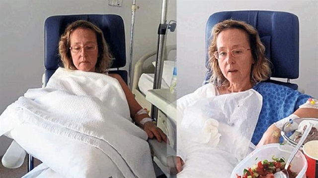 Diş doktoru, kolu kırık diye gittiği hastanede kolu kangren olunca kesildi.