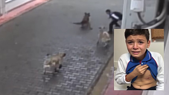 Aç köpekler küçük çocuğa dehşeti yaşattı