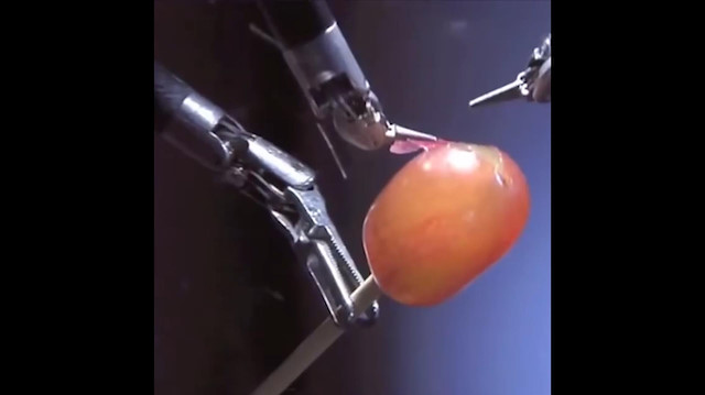 Cerrah robot üzümü ameliyat ediyor