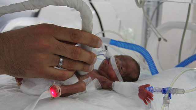 514 gram ağırlığındaki bebek operasyon sonrası kilo almaya başladı.