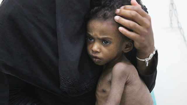 Yemen'de 5 milyon çocuğa çocuk felci aşısı yapıldı