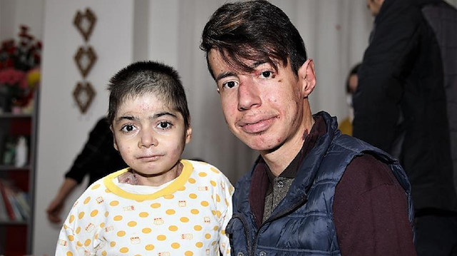 Kelebek hastası Çalışır, kendisi gibi aynı hastalıkla mücadele eden Aydın kardeşlere moral verdi.