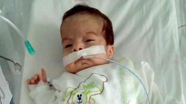 Açık kalp ameliyatı yapılan 13 günlük bebek sağlığına kavuştu.
