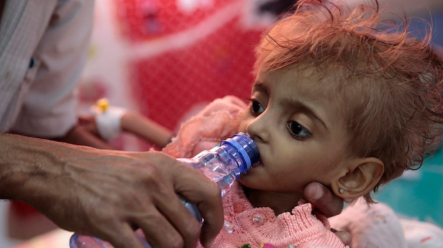 Yemen'de ölüm sınırında 400 bin bebek ve çocuk var