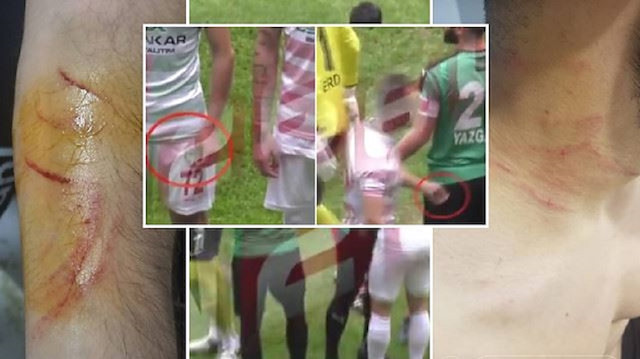 SavcÄ±lÄ±k, Sakaryasporlu futbolcularÄ±n Åikayeti Ã¼zerine Mansur Ãalar hakkÄ±nda soruÅturma baÅlatmÄ±ÅtÄ±. 