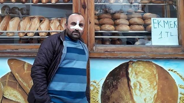 250 gram ekmeği 1 liradan satan fırın sahibi Bayram Tetik, darp edildi.