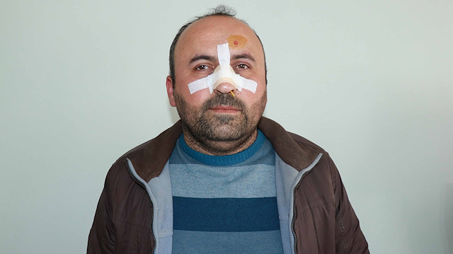 Saldırıya uğrayan ve burnu kırılan fırın sahibi.