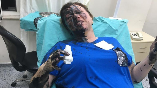 Yüzüne siyah madde dökülüp tehdit edilen iş kadınının isyanı