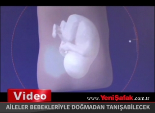 Aileler bebekleriyle doğmadan tanışabilecek