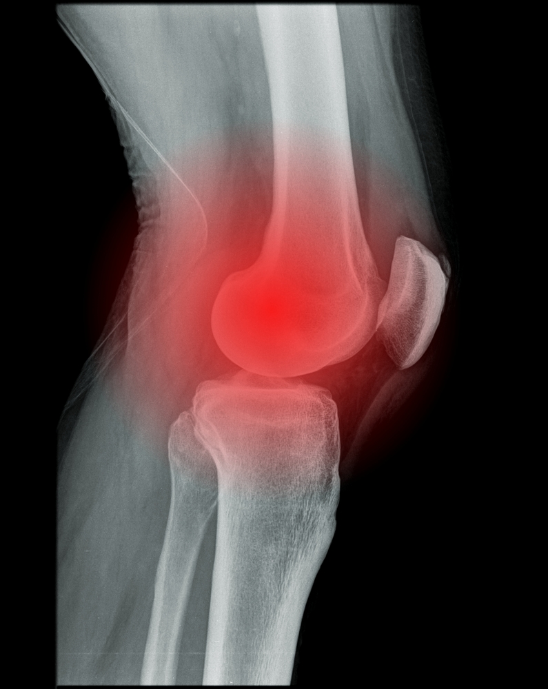Thermage nerelere uygulanır ile Etiketlenen Konular Thermage nerelere uygulanır ile Etiketlenen Konular