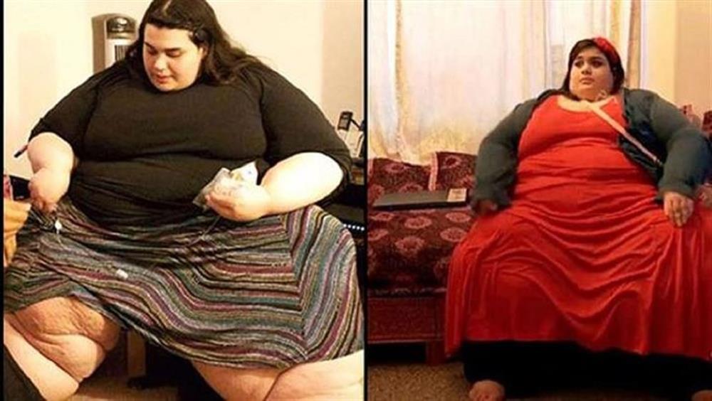 Super Obese Amber Loses An Astonishing 200kg super-obese-amber-loses-an-astonishing-200kg
